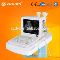 equipamento de diagnóstico médico scanner de ultrassom preço com desconto e ultrassom portátil máquina 3d workstation
